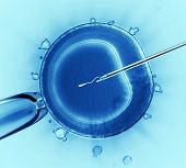 ICSI: Hope for couples with male factor infertility